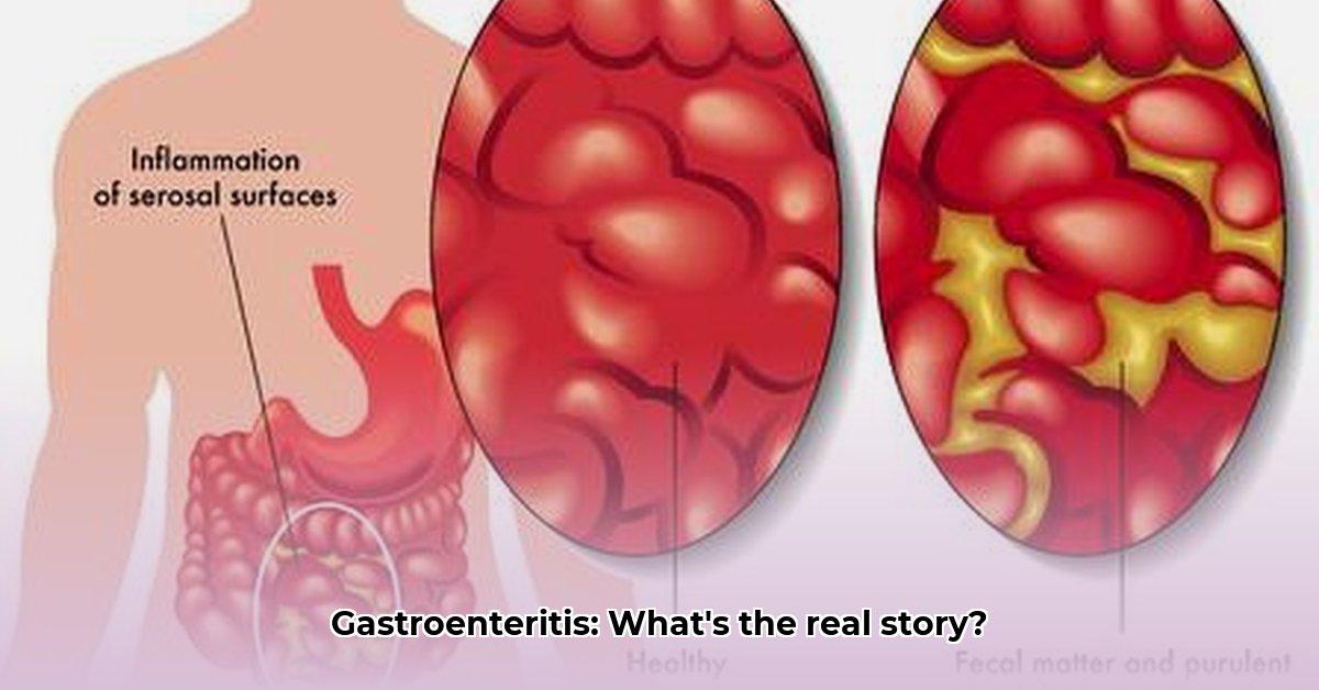 gastroenteritis-betekenis